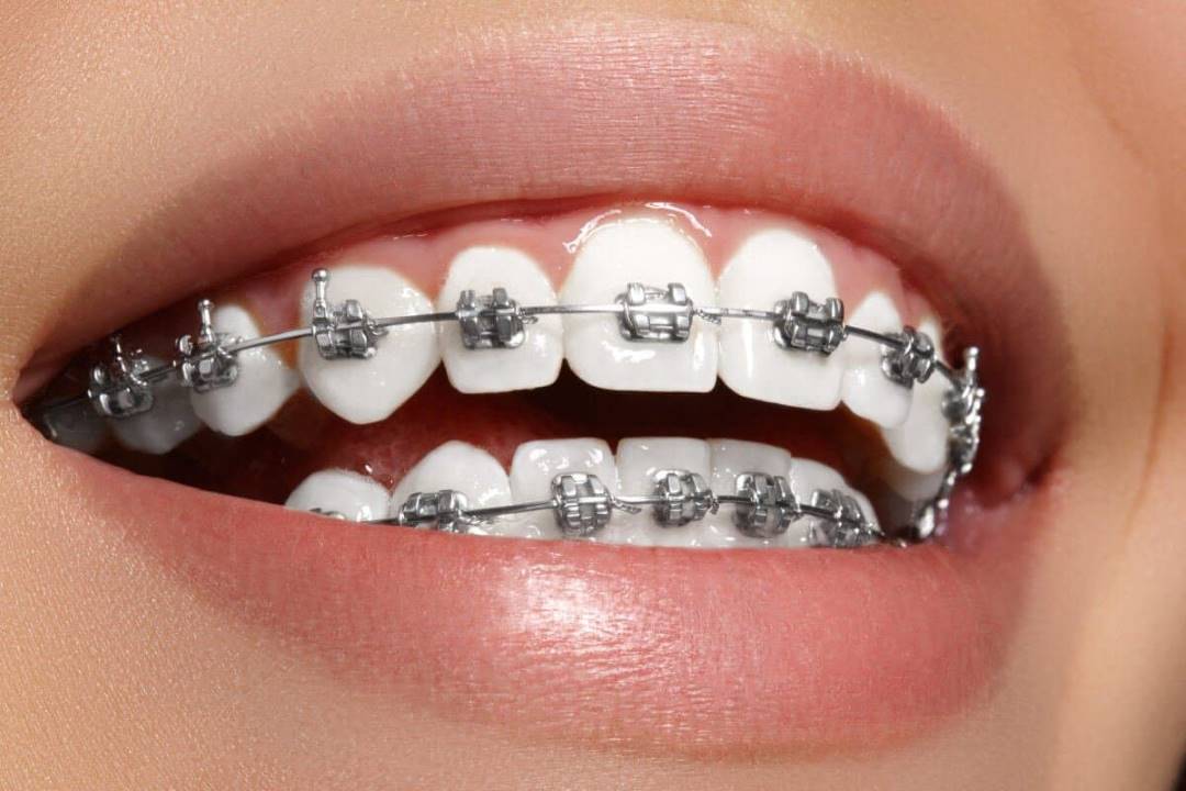 مقاله شماره 2